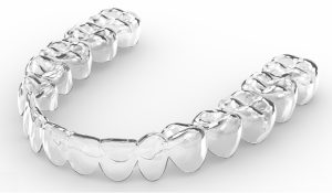 Invisalign Cost