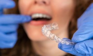 Invisalign Dentist