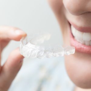 Invisalign Price Hornsby